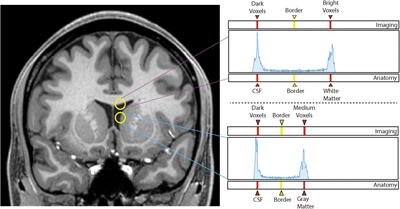 Anatomically curated segmentation of human subcortical structures in high resolution magnetic resonance imaging: An open science approach